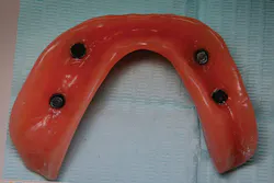 1712desch P11 1712desch P11