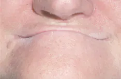 1803dechr P02 1803dechr P02