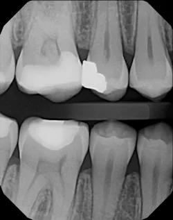 1804detom P01 1804detom P01