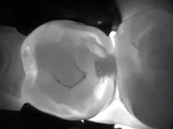 1804detom P02 1804detom P02