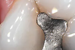 1804detom P03 1804detom P03