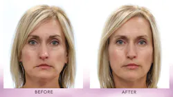 1807demal P01 1807demal P01