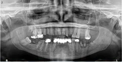 1808denaz P03 1808denaz P03