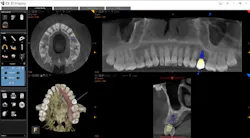 1808denaz P04 1808denaz P04