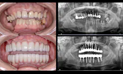 1808denaz P06 1808denaz P06