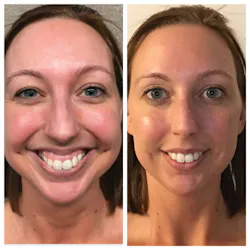 1809demal P01 1809demal P01