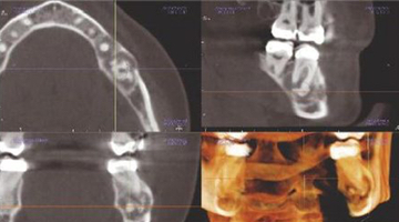 Content Dam De En Articles Print Volume 106 Issue 8 Science Tech A Radiologist S View Of In Office Cbct Interview With Jeffery B Price Dds Ms Leftcolumn Article Thumbnailimage File