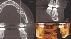 Content Dam De En Articles Print Volume 106 Issue 8 Science Tech A Radiologist S View Of In Office Cbct Interview With Jeffery B Price Dds Ms Leftcolumn Article Thumbnailimage File Content Dam De En Articles Print Volume 106 Issue 8 Science Tech A Radiologist S View Of In Office Cbct Interview With Jeffery B Price Dds Ms Leftcolumn Article Thumbnailimage File