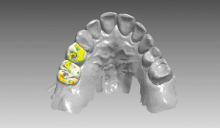 Content Dam De En Articles Print Volume 107 Issue 12 Science Tech Does Digital Dentist Mean Anything Today Leftcolumn Article Thumbnailimage File