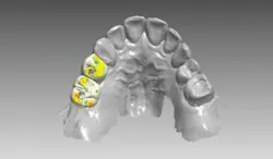 Content Dam De En Articles Print Volume 107 Issue 12 Science Tech Does Digital Dentist Mean Anything Today Leftcolumn Article Thumbnailimage File Content Dam De En Articles Print Volume 107 Issue 12 Science Tech Does Digital Dentist Mean Anything Today Leftcolumn Article Thumbnailimage File
