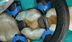 LaserFousWorld LaserFousWorld