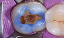 LaserFousWorld Test LaserFousWorld Test