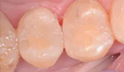 LaserFousWorld Test LaserFousWorld Test