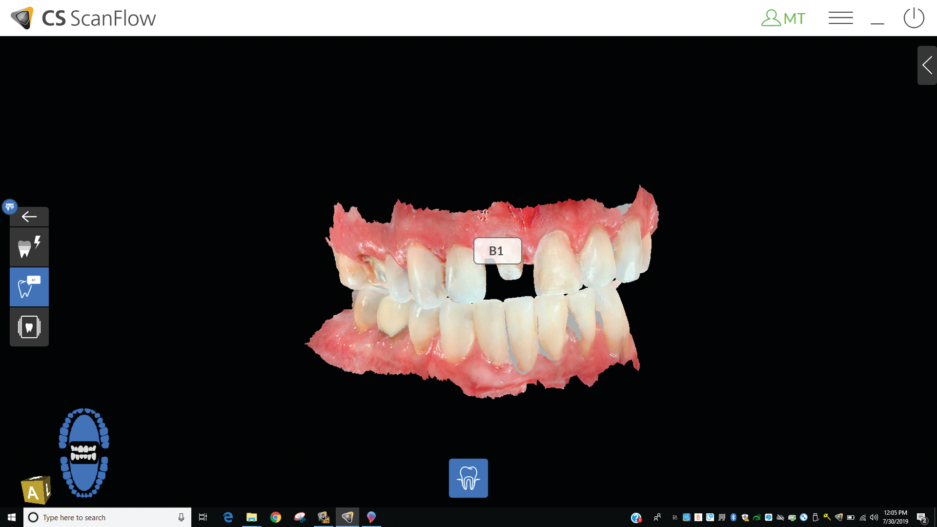 1910 De Ckel P04 5daf14b5ab071