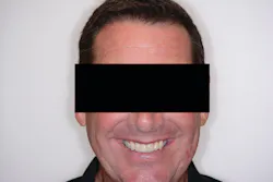 Figure 5: The happy patient Figure 5: The happy patient