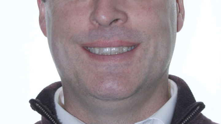 1911 De Cchr P01 5db741e9192dd