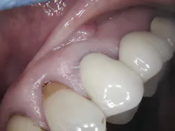 Figure 2: Pre-op Figure 2: Pre-op