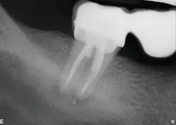 Figure 2: Six-month recall—case 1 Figure 2: Six-month recall—case 1