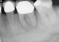 Figure 3: Case 2 presentation Figure 3: Case 2 presentation