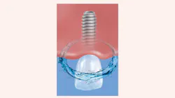 2003 Rd Hwin Thumb 5e692ee1b4cf2 2003 Rd Hwin Thumb 5e692ee1b4cf2