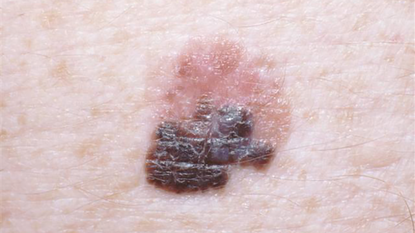 2004 De Cspi P04 5e87a054dfdff