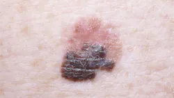 2004 De Cspi P04 5e87a054dfdff 2004 De Cspi P04 5e87a054dfdff