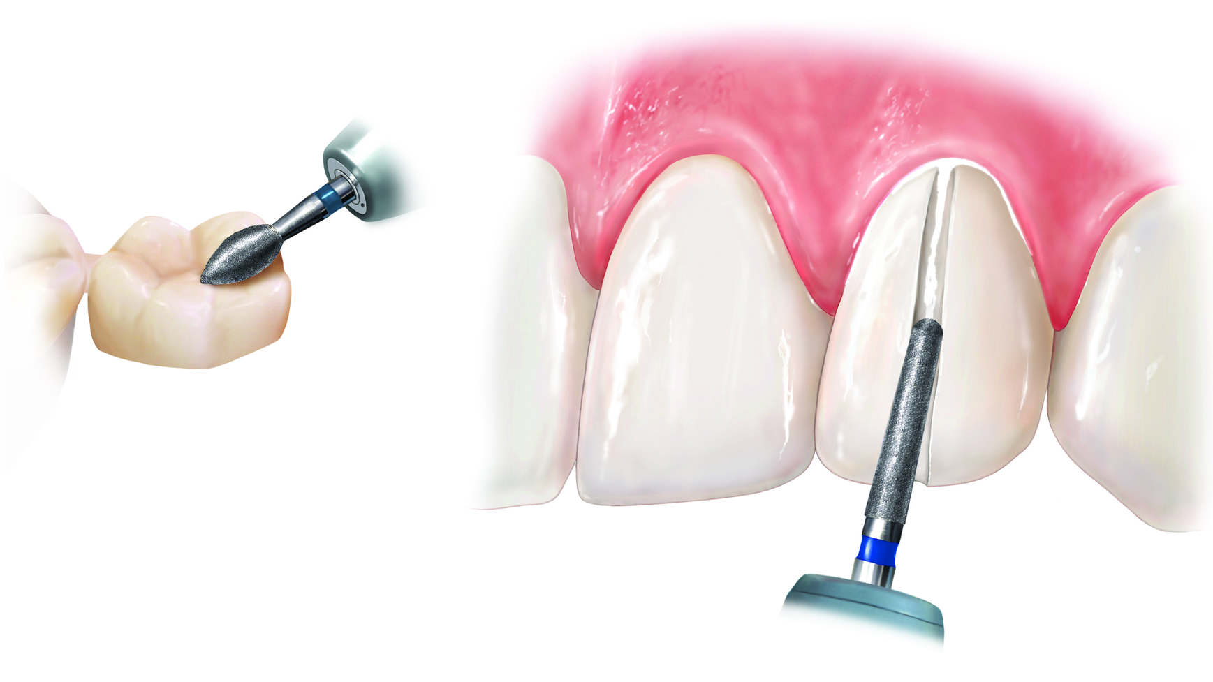 2004 De Cpea2 P01 5ebabe0983252