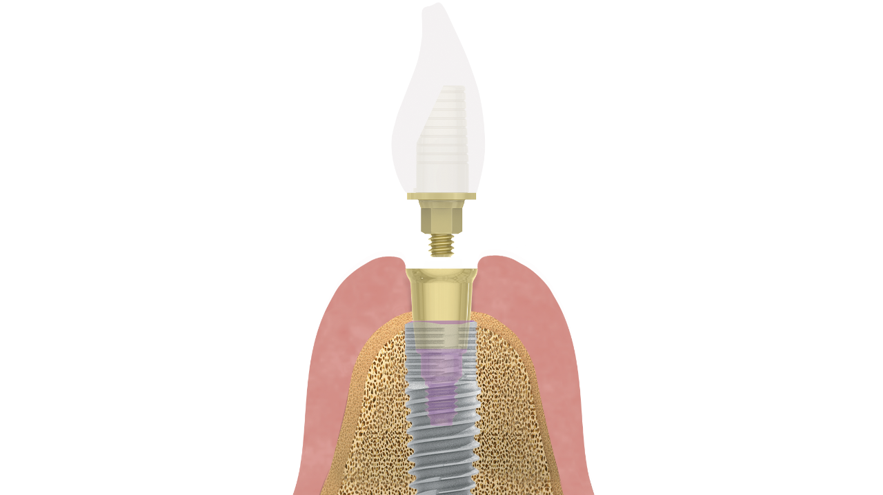 2005 De Cpea1 P01 5ebabbf9d532d