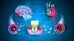Copyright Guniita Dreamstime Perio And Heart Oral Systemic Copyright Guniita Dreamstime Perio And Heart Oral Systemic