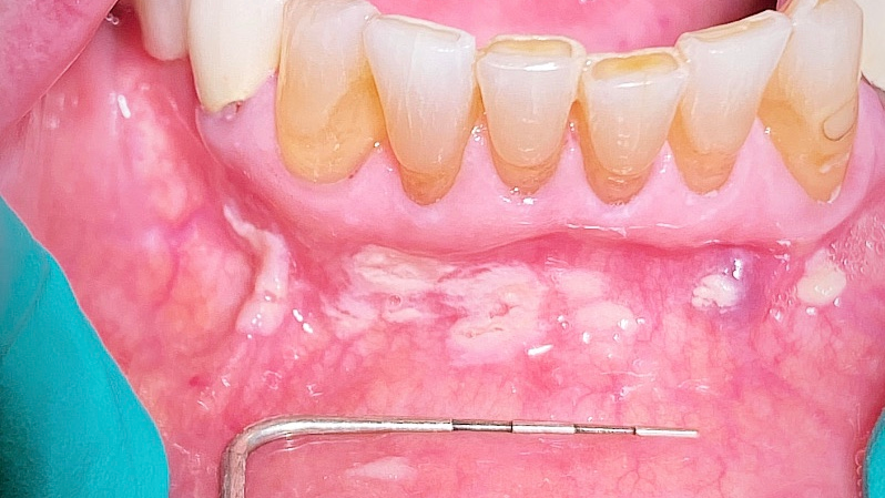 2012 De Cgiv P01 5fbead77cfff9