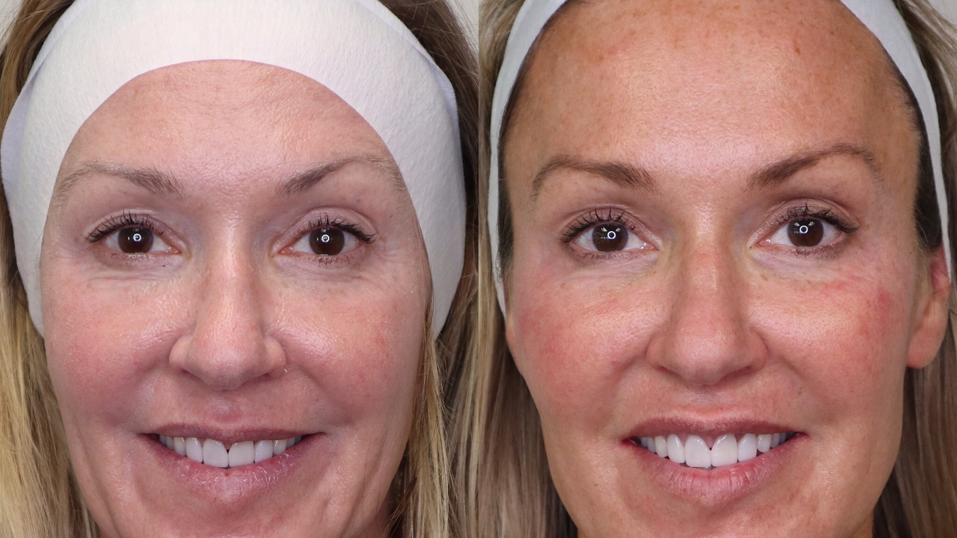 Figure 1: Before and after photos, including dental and facial esthetics, are powerful drivers for attracting new patients.