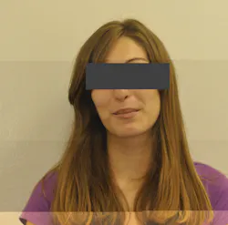 Figure 1: Patient is struggling and uncomfortable Figure 1: Patient is struggling and uncomfortable