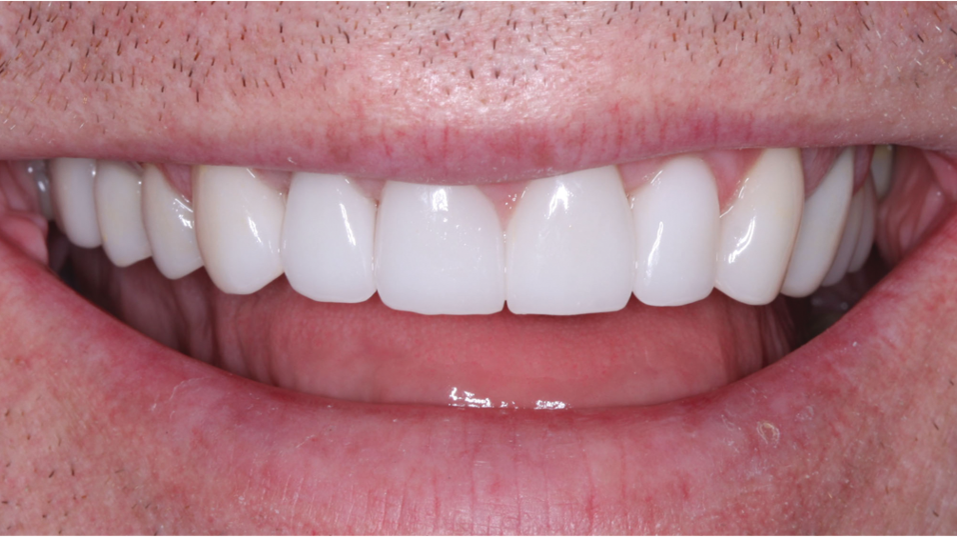 2105 De Cchr P05 6091ab2e9a747