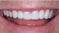 2105 De Cchr P05 6091ab2e9a747 2105 De Cchr P05 6091ab2e9a747