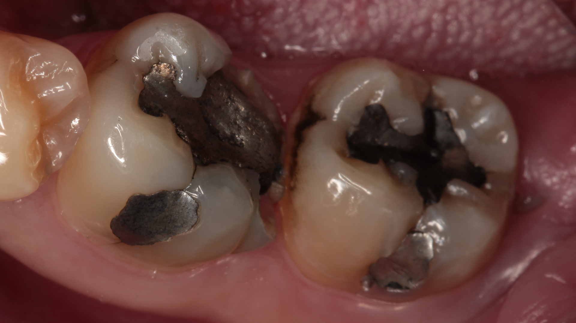 Figure 1: Initial presentation