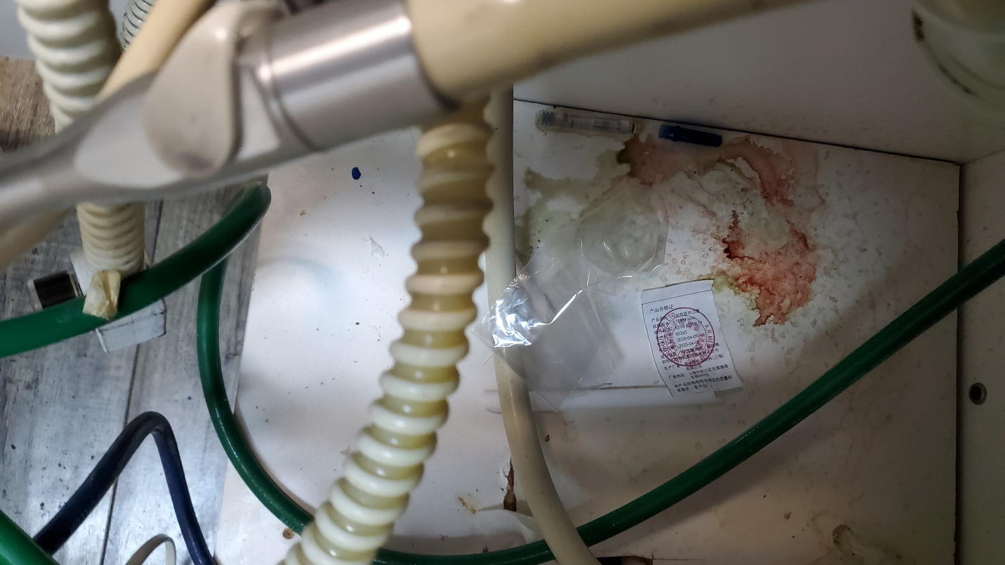 In dental treatment room is cabinetry for exit of suction line and space for dental handpieces on an extended arm. Note used torn glove fingertip on suction line, white suction tip used in patient&rsquo;s mouth, clear plastic barrier for digital x-ray cover, diamond bur used in patient&rsquo;s mouth, used blue injection needle cap, a &ldquo;made in China&rdquo; supply label, and human blood splatter from leaks in suction line.