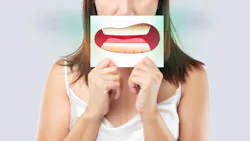 Dreamstime Xxl 221219668 616065a3b3913 Dreamstime Xxl 221219668 616065a3b3913