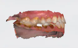 Figure 4: Trios scan (right) Figure 4: Trios scan (right)