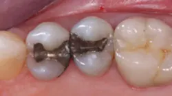 Screen Shot 2022 02 25 At 4 25 14 Pm 62194947a84f4 Screen Shot 2022 02 25 At 4 25 14 Pm 62194947a84f4