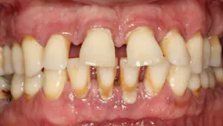 Figure5 627408f5601f8 Figure5 627408f5601f8