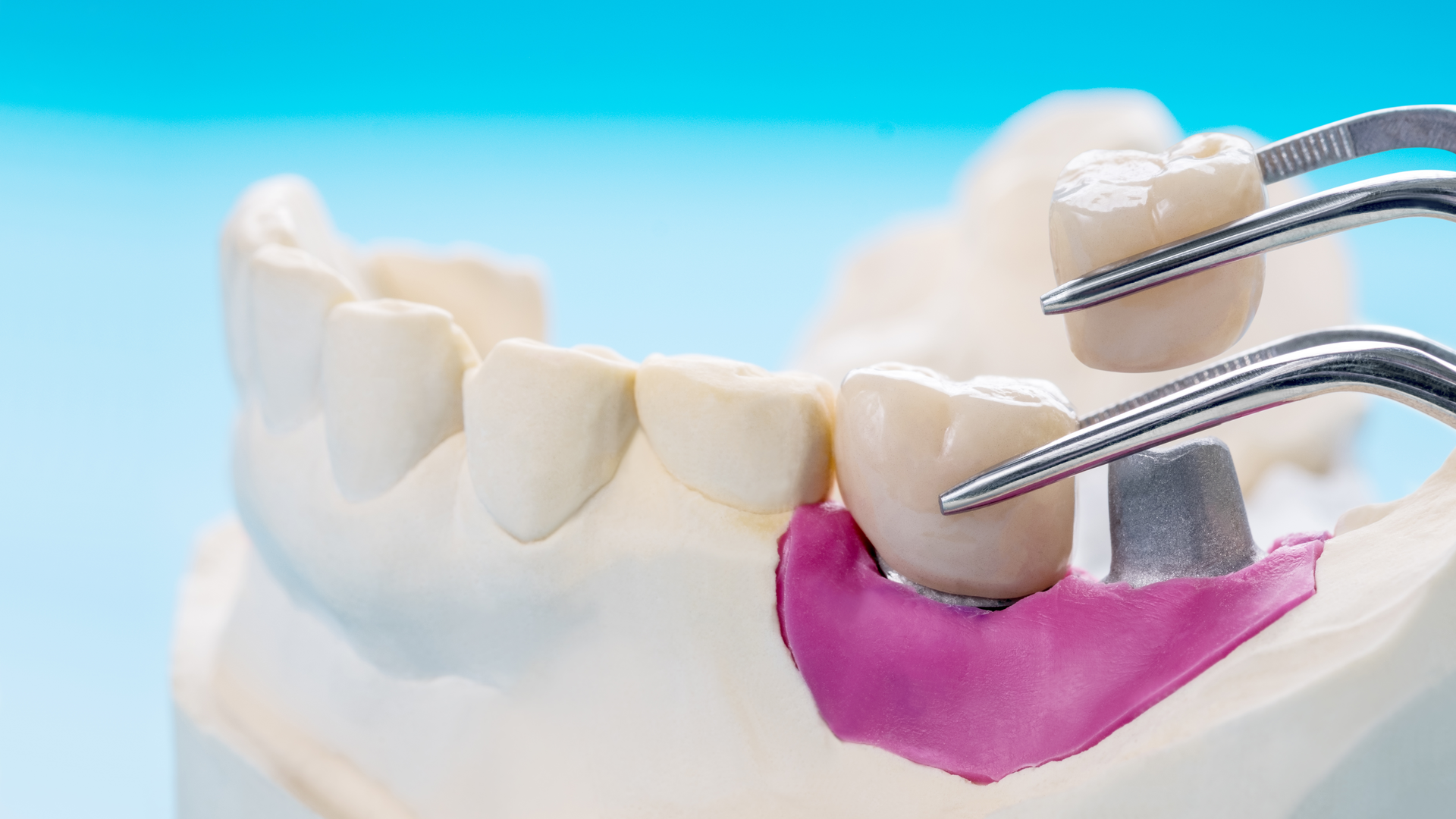 Getty Images 1279731640 636e9961d318e