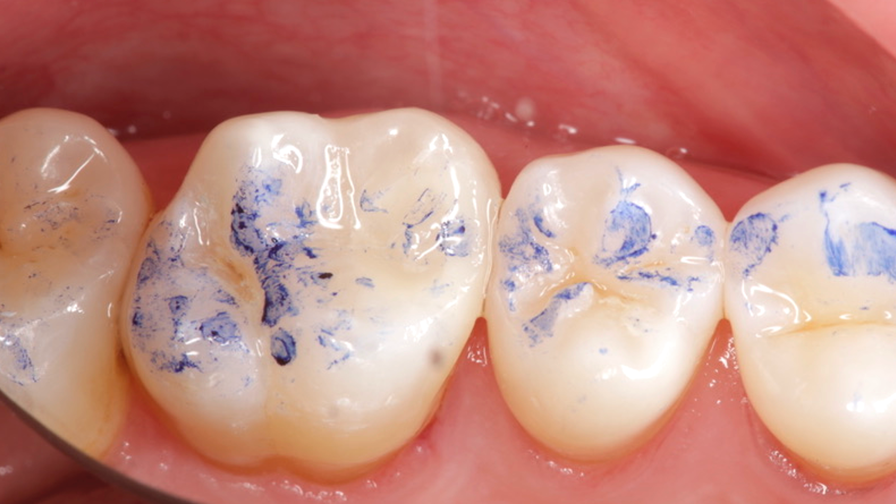 Figure28 63c06e063a6e8 63e421333b334