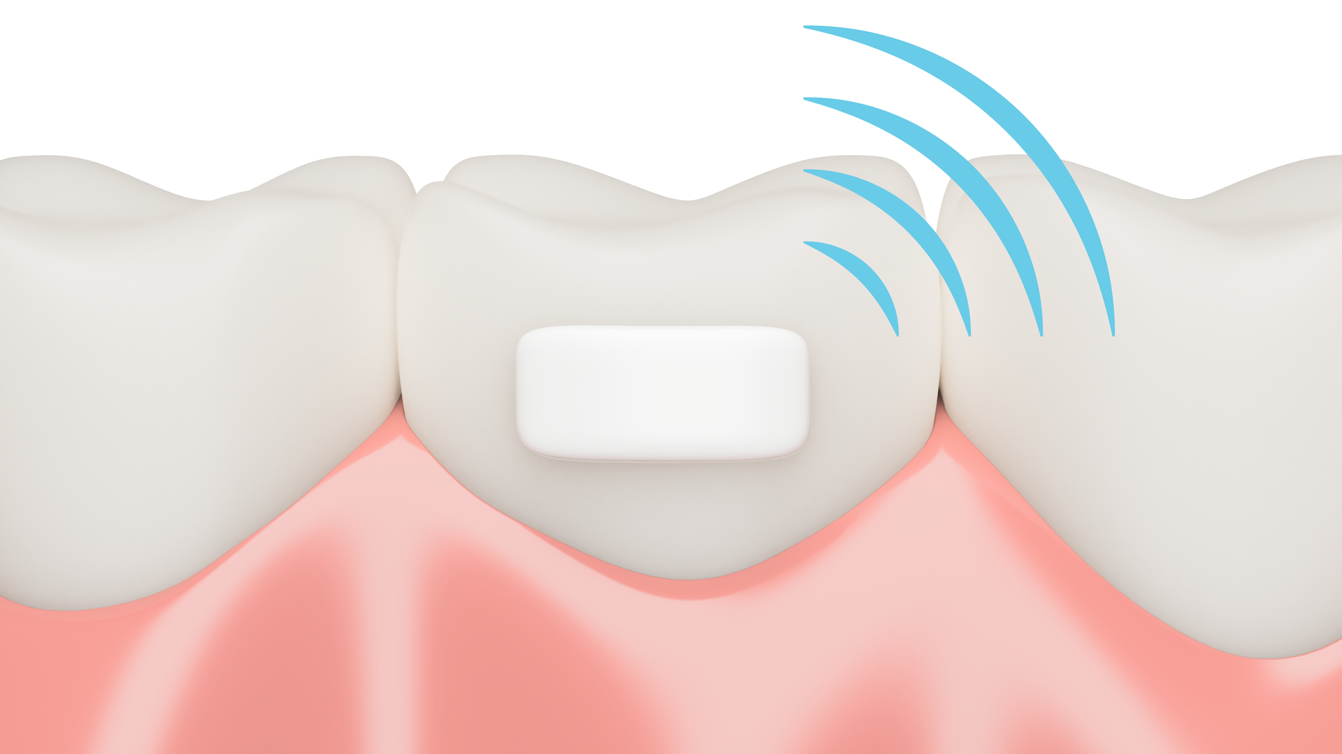 Smart Band With Signal 6408f007f2d82