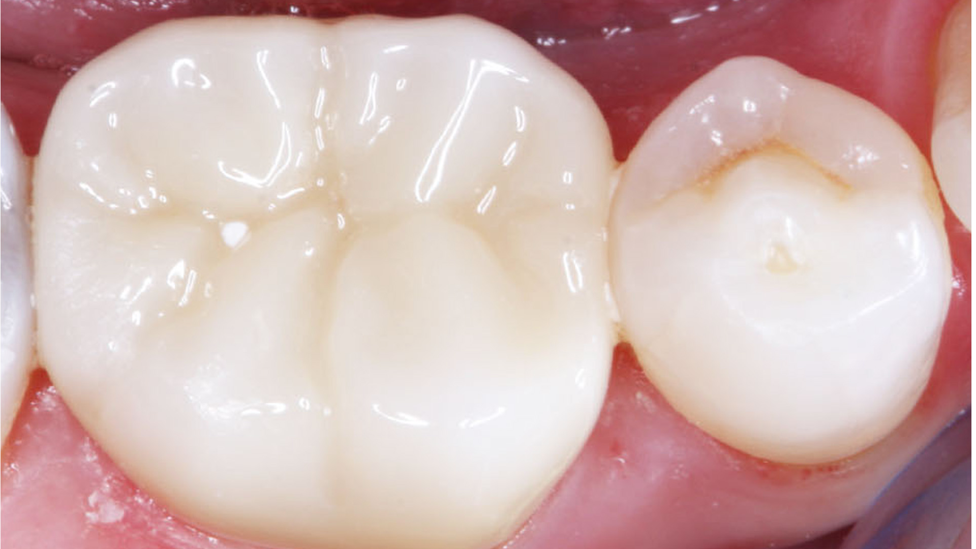 Primary 6408f7e5f3cf3