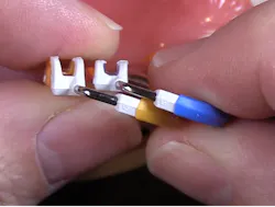 Figure 1: Note the angulation of the Composi-Tight 3D Fusion rings that allows for better stackability. Figure 1: Note the angulation of the Composi-Tight 3D Fusion rings that allows for better stackability.
