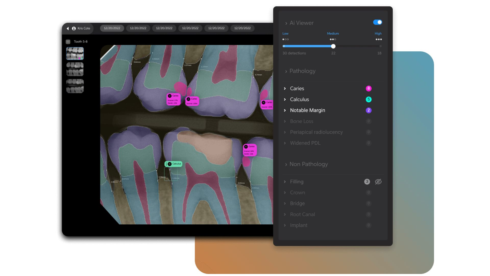 Untitled Design 9 645d42dd8de9b