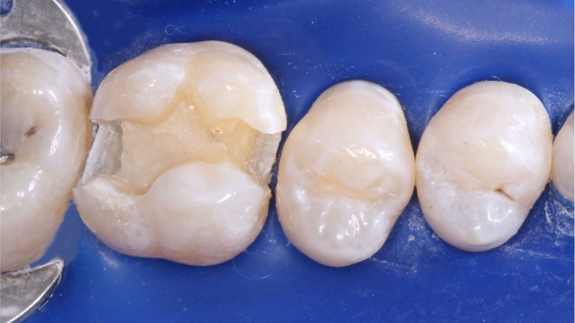 Figure2 64ad9670c3d65