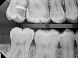 figure_1b_preop_bw figure_1b_preop_bw