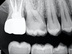 figure_4b_crown_delivery_bwpa figure_4b_crown_delivery_bwpa