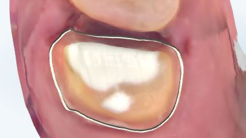 659ed87534eee6001e4b0fc5 Primary